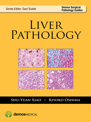 cover image of Liver Pathology